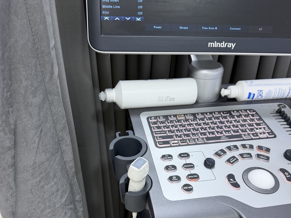 جهاز Mindray المستخدم لفحص إيكو القلب في عيادة طبربور